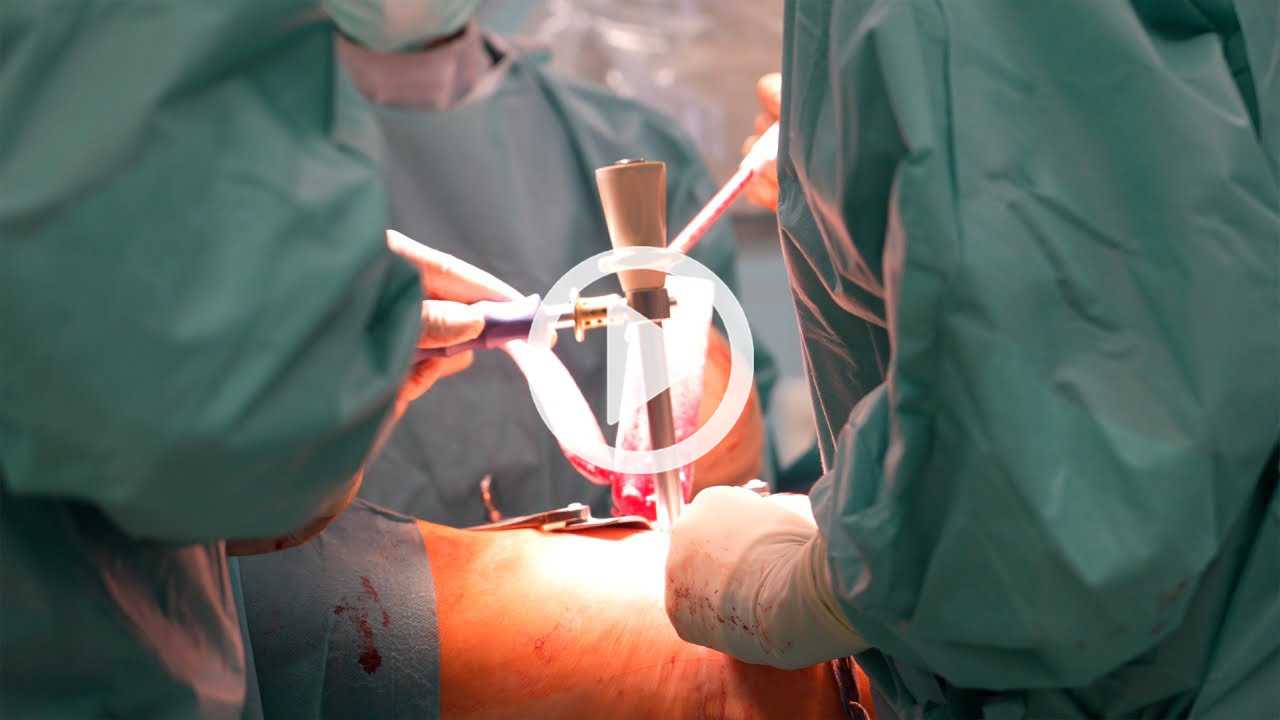 Wirbelsäulenchirurgie